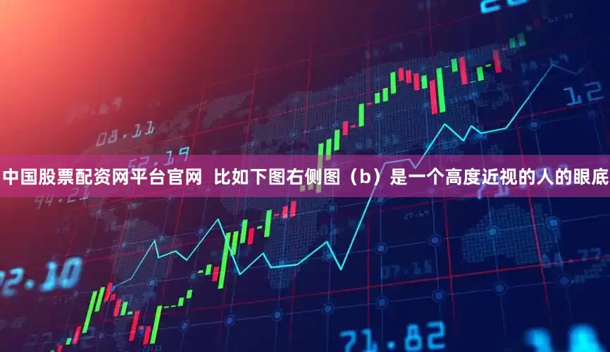 中国股票配资网平台官网  比如下图右侧图（b）是一个高度近视的人的眼底